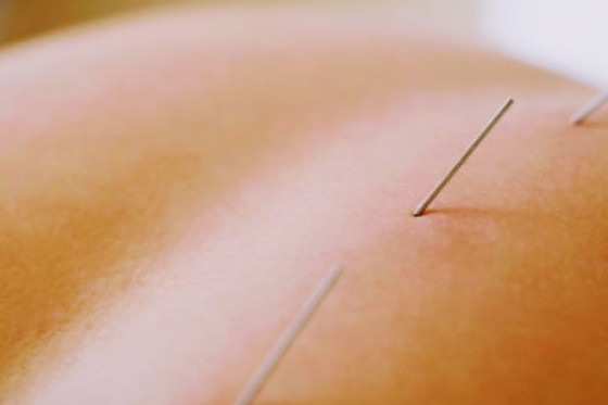 ESFERAL FISIOTERAPIA - photo 2
